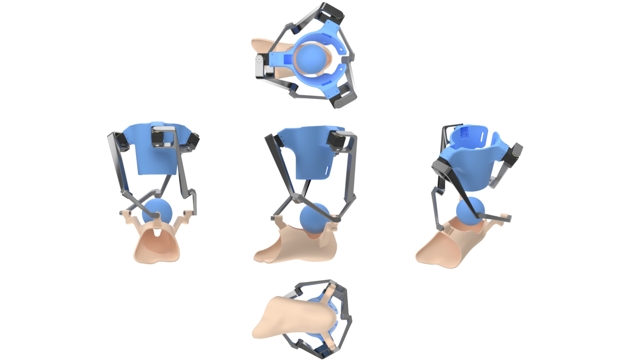 Ankle Rehabilitation Robot